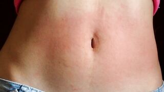 I show my red abdomen from the punishment I received from the red stomach game, my belly inflamed