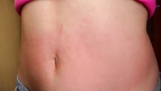 I show my red abdomen from the punishment I received from the red stomach game, my belly inflamed